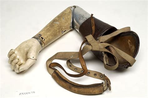 prosthetic limbs history